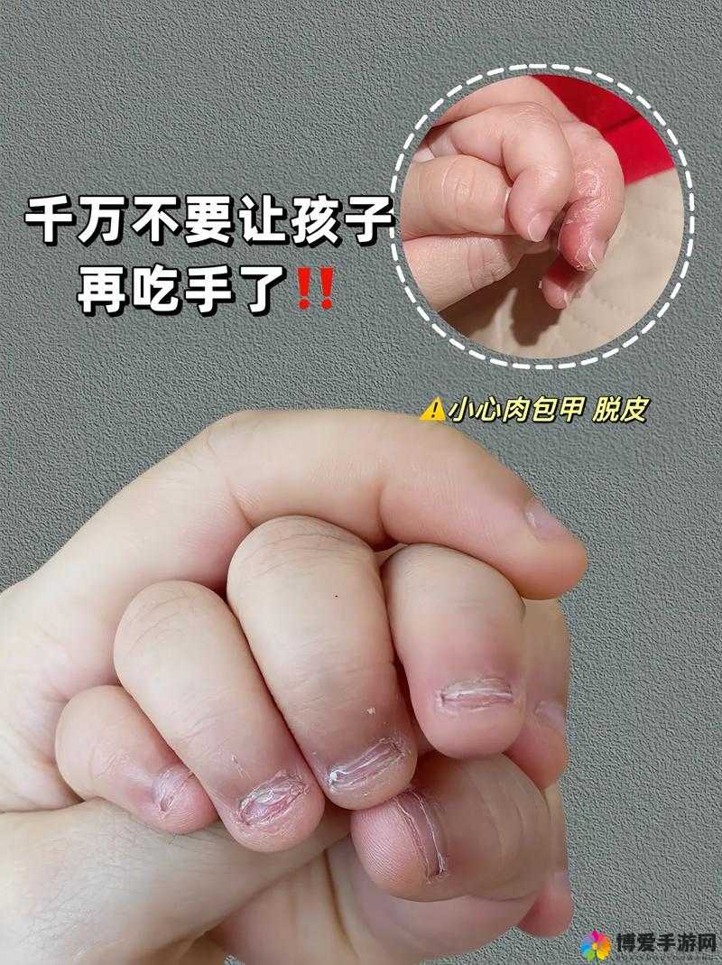 宝宝才两根手指就哭了：这是咋回事